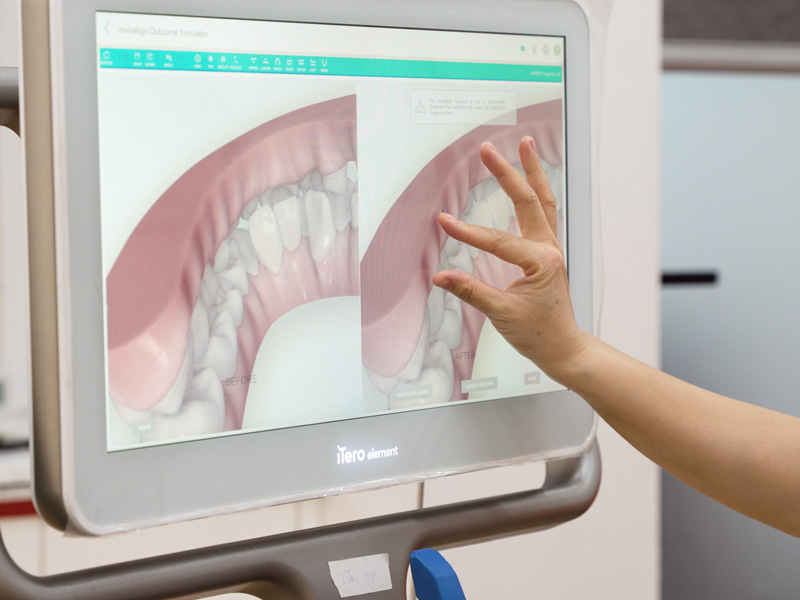 Dịch vụ niềng răng chuyên nghiệp